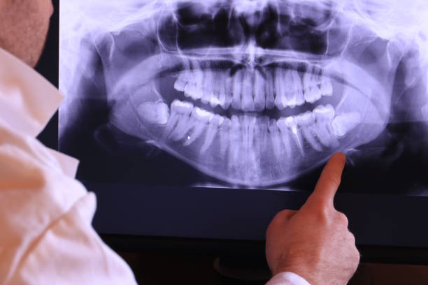 Best Tooth Pain Emergency Relief  in Hamton, IL