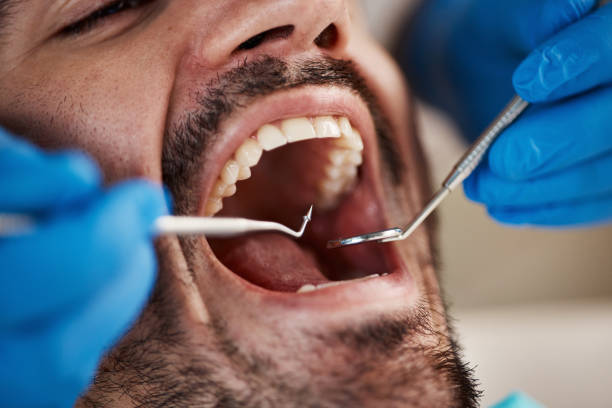 Best Knocked-Out Tooth Emergency  in Hamton, IL